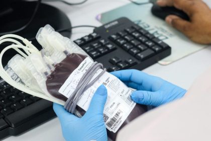 Hemose promove sexta edição do ‘Sabadão Solidário’ neste sábado, 20
